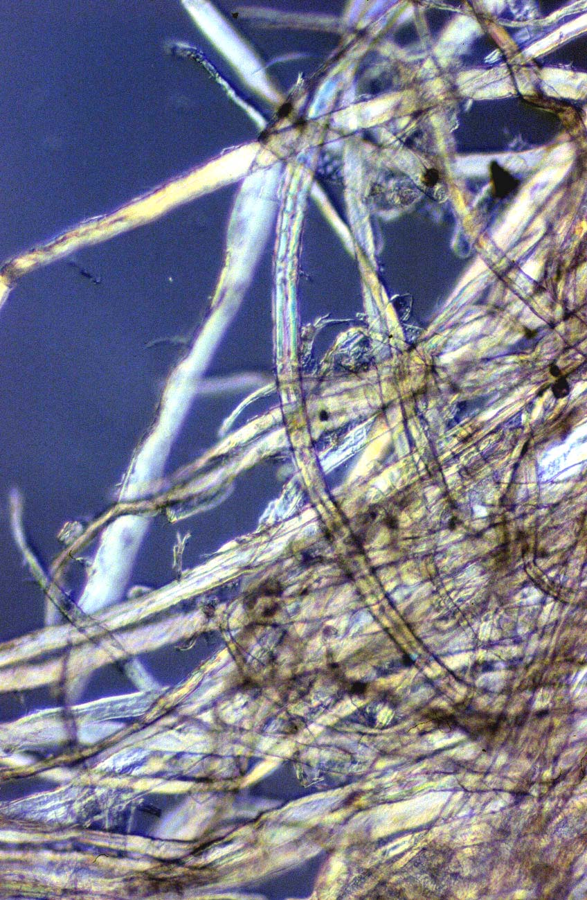 Magnified Hair Strand