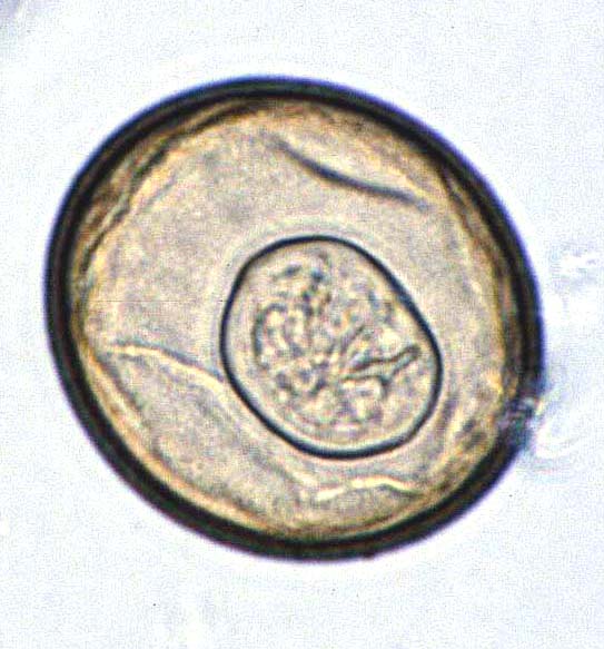 Diphyllobothrium Latum Egg