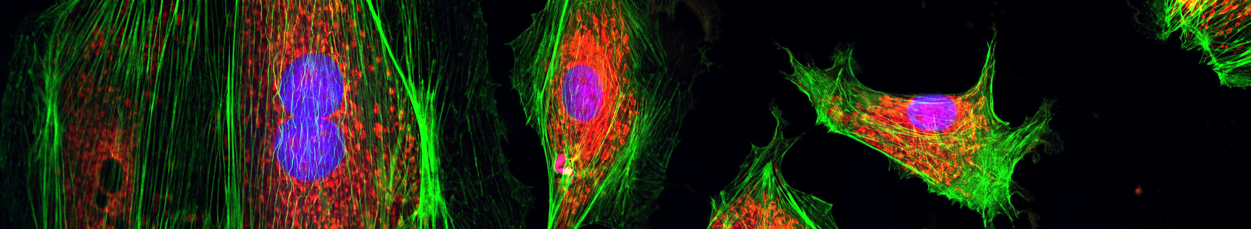 bovine pulmonary artery endothelial