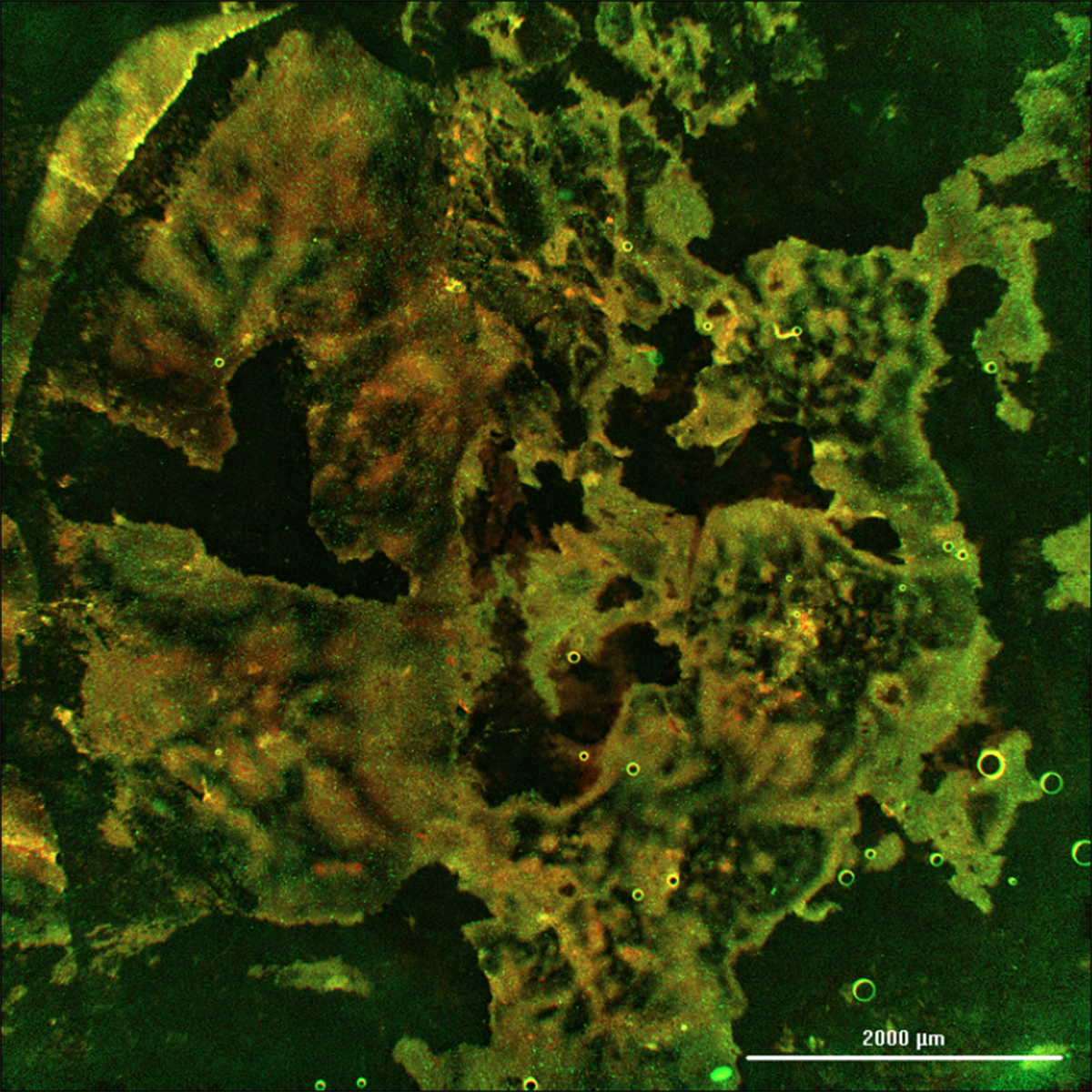 A microscopic slide shows a positive sample of rabies in a bat as brownish-green blobs on a black background.