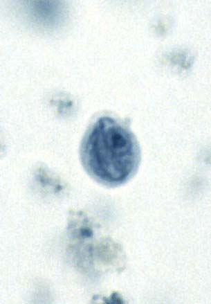 chilomastix mesnili trophozoites