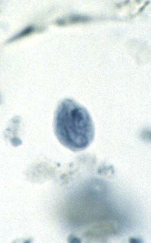 chilomastix mesnili trophozoites