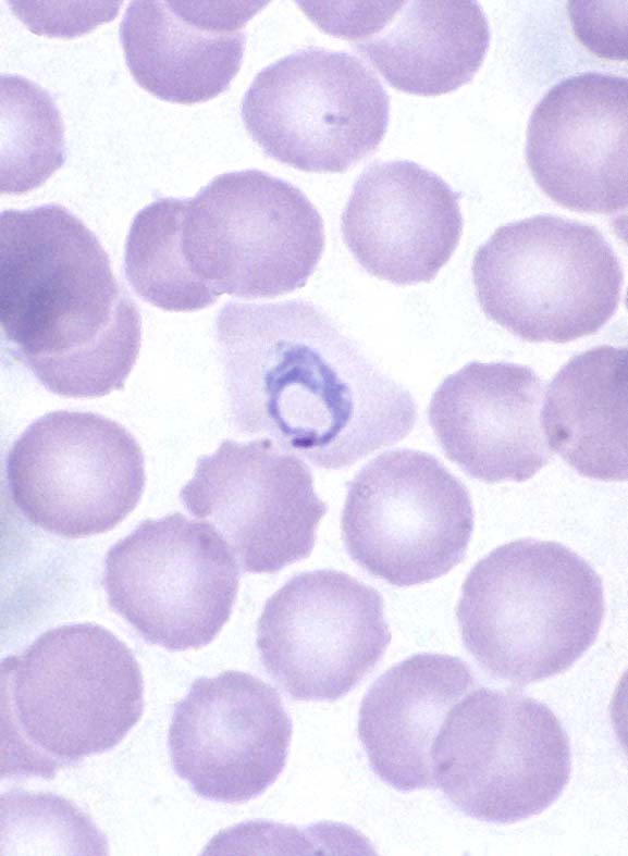 Plasmodium falciparum Blood Stage Parasites, Thin Blood Smears