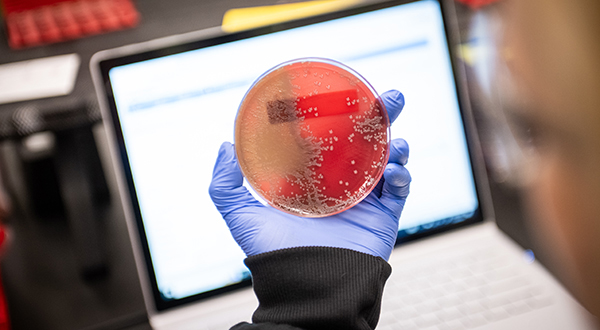 A researcher with a blue glove holds up a red bacteria culture.